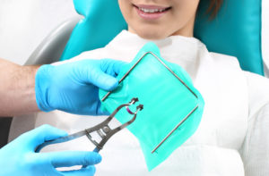 Root Canal in Pembroke Pines